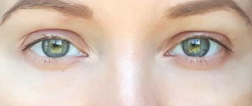 Blåmerker under øynene: hvordan å dekke opp og ikke stresset alder